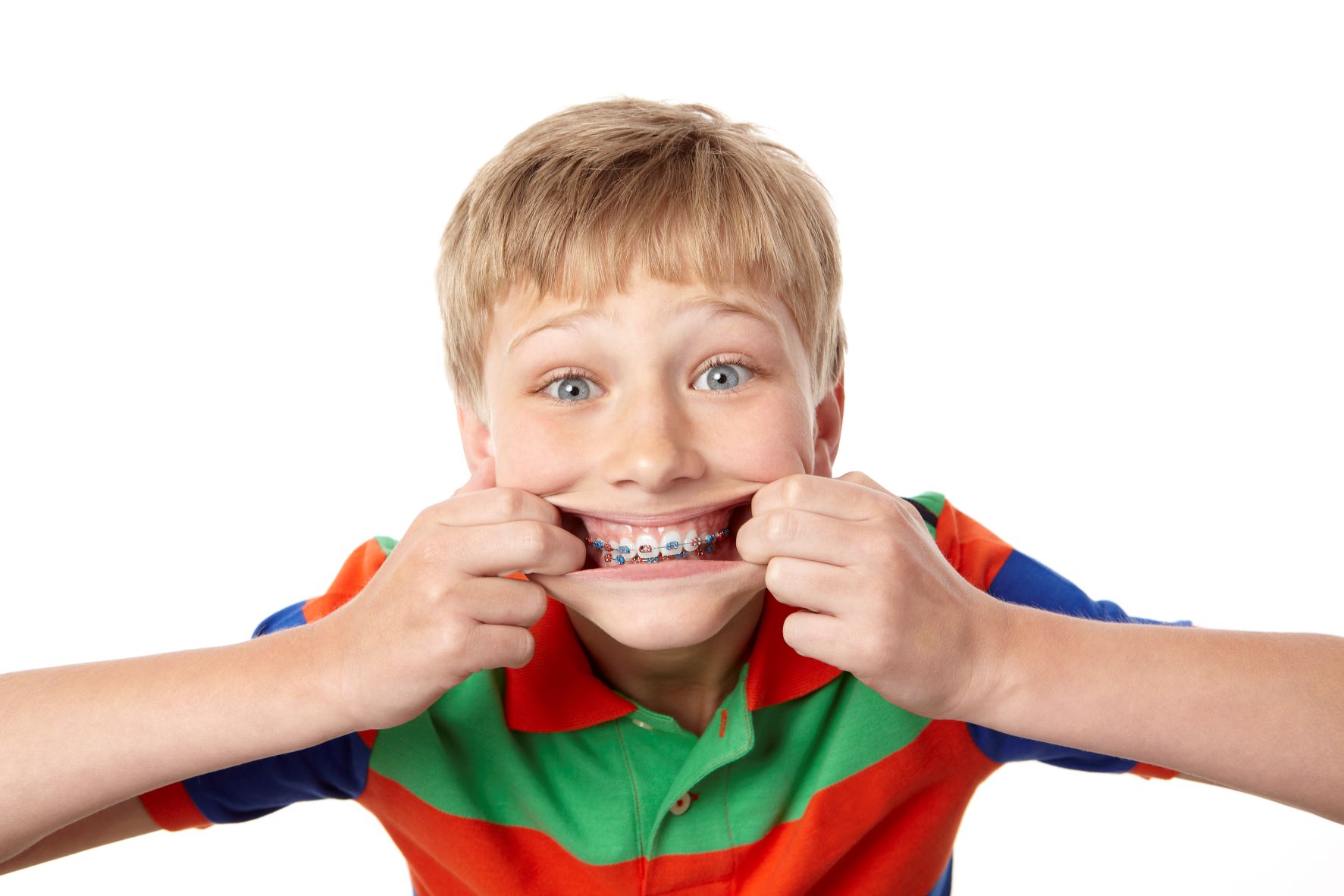 Feste Zahnspange bei Kindern